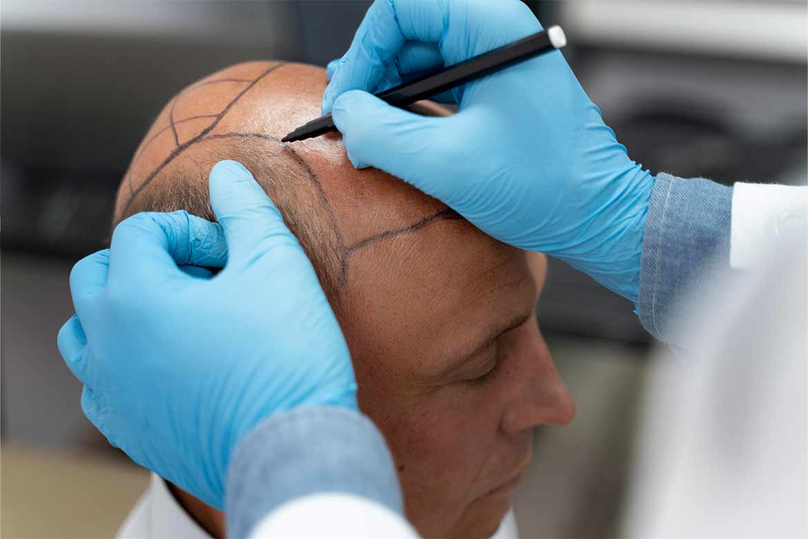 haircandidate